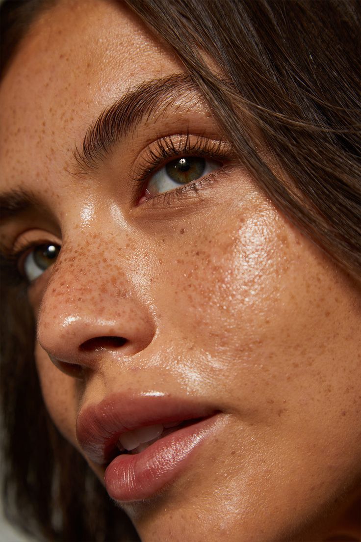 RF MicroNeedling Boca Raton FL Ora Aesthetics and Wellness