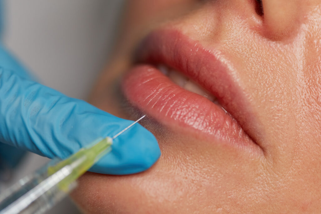 lip injection boca raton