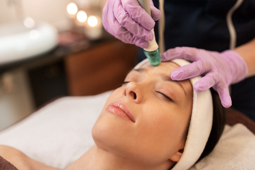 microneedling boca raton