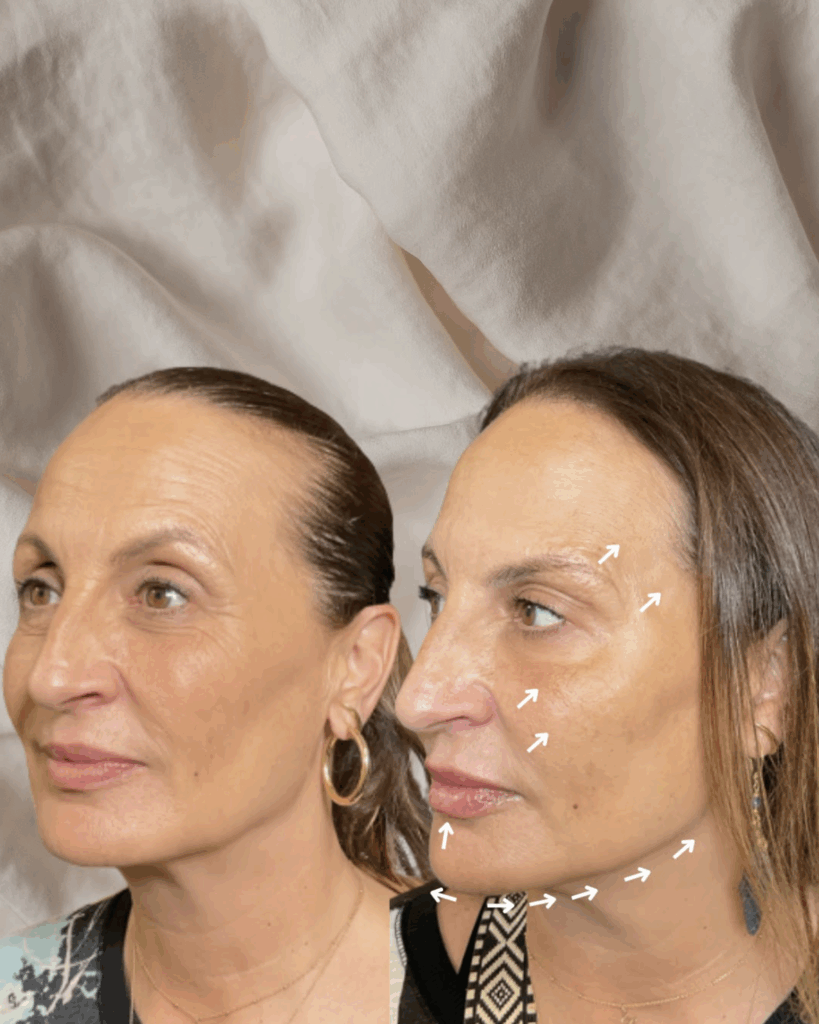 facial balancing boca raton