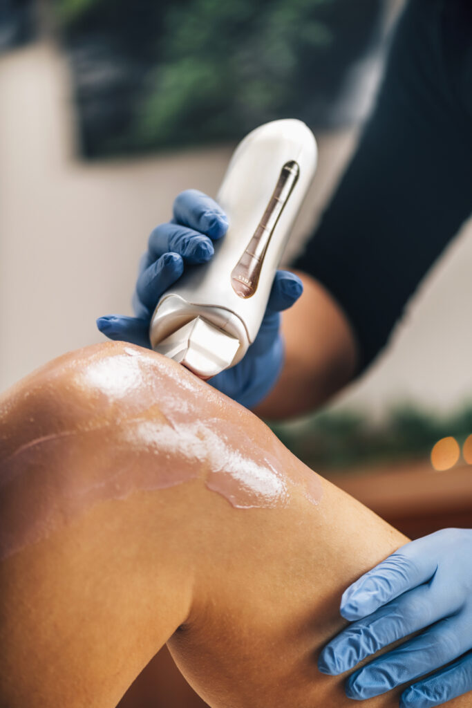 laser hair removal boca raton fl