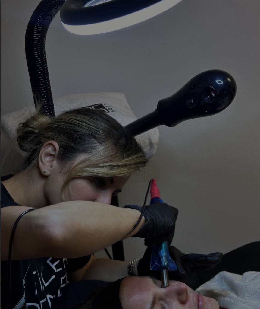 The Benefits of Microneedling in Boca Raton